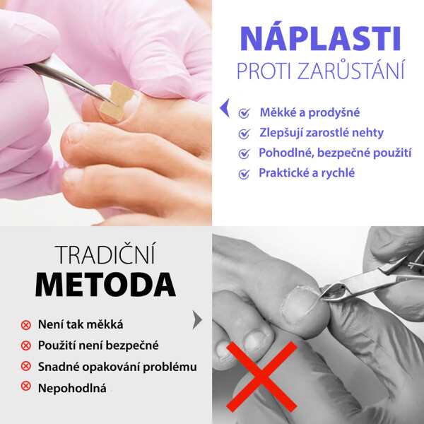 naplasti-trend_1.jpg